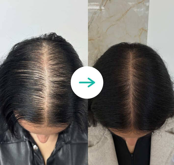 prueba antes despues 02