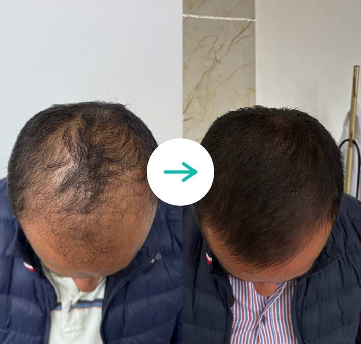 prueba antes despues 03